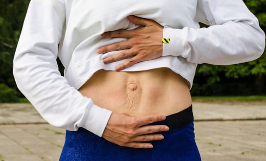 diastasis